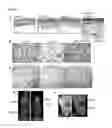 Fig. 05 - Compositions and methods for induced brown fat differentiation