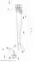 Fig. 27 - THERMAL SURGERY SAFETY APPARATUS AND METHOD