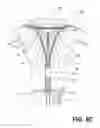 Fig. 11 - Methods and systems for endometrial ablation