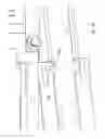 Fig. 16 - Electrical surgical instrument with optimized power supply and drive