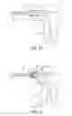 Fig. 21 - Electrosurgical cutting and sealing instrument