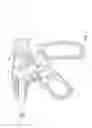 Fig. 03 - Electrosurgical cutting and sealing instrument
