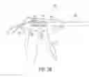 Fig. 24 - Electrosurgical cutting and sealing instrument