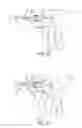 Fig. 17 - Electrosurgical cutting and sealing instrument