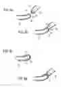 Fig. 05 - Method of fusing layers of biological tissue