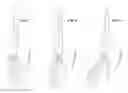 Fig. 05 - INTRAMEDULLARY ARTHRODESIS NAIL AND METHOD OF USE