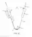 Fig. 05 - Flexible tissue removal devices and methods