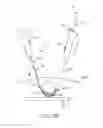 Fig. 12 - Flexible tissue removal devices and methods