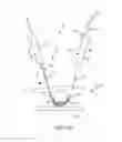 Fig. 13 - Flexible tissue removal devices and methods