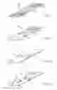 Fig. 15 - Flexible tissue removal devices and methods