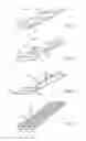 Fig. 17 - Flexible tissue removal devices and methods