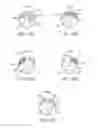 Fig. 22 - Flexible tissue removal devices and methods
