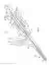 Fig. 04 - Apparatus and methods for use of expandable members in surgical applications