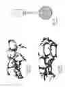 Fig. 07 - Bone cement system for bone augmentation