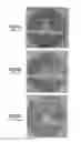 Fig. 09 - Bone cement system for bone augmentation