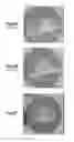 Fig. 10 - Bone cement system for bone augmentation