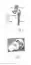Fig. 02 - Surgical device