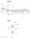 Fig. 07 - Intraocular lens insertion device
