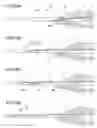 Fig. 21 - Intraocular lens insertion device