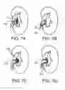 Fig. 10 - Filter apparatuses and methods of using same