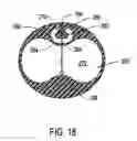 Fig. 17 - Delivery assembly for percutaneously delivering and deploying an electrode array at a target location, the assembly capable of steering the electrode array to the target location