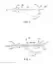 Fig. 03 - Side looking minimally invasive surgery instrument assembly