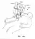 Fig. 31 - Side looking minimally invasive surgery instrument assembly