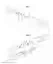 Fig. 02 - Surgical instrument