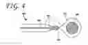 Fig. 08 - Tissue ligation devices and methods