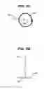 Fig. 04 - METHODS AND DEVICES FOR PLACEMENT OF AN INTRA-ABDOMINAL OR INTRA-THORACIC APPLIANCE THROUGH A NATURAL BODY ORIFICE