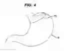 Fig. 05 - METHODS AND DEVICES FOR PLACEMENT OF AN INTRA-ABDOMINAL OR INTRA-THORACIC APPLIANCE THROUGH A NATURAL BODY ORIFICE