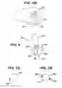 Fig. 07 - METHODS AND DEVICES FOR PLACEMENT OF AN INTRA-ABDOMINAL OR INTRA-THORACIC APPLIANCE THROUGH A NATURAL BODY ORIFICE