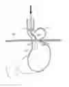Fig. 01 - Apparatus for treating GERD