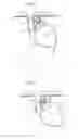 Fig. 03 - Apparatus for treating GERD