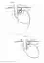 Fig. 04 - Apparatus for treating GERD