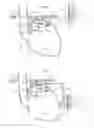 Fig. 05 - Apparatus for treating GERD