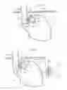Fig. 07 - Apparatus for treating GERD