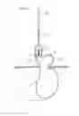 Fig. 19 - Apparatus for treating GERD
