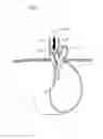 Fig. 20 - Apparatus for treating GERD