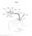 Fig. 27 - Apparatus for treating GERD