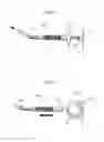 Fig. 31 - Apparatus for treating GERD