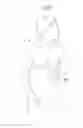 Fig. 40 - Apparatus for treating GERD