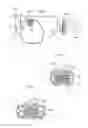 Fig. 59 - Apparatus for treating GERD