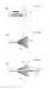 Fig. 80 - Apparatus for treating GERD