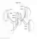 Fig. 89 - Apparatus for treating GERD