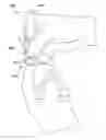 Fig. 01 - Collapsible lancing device