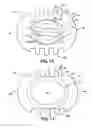 Fig. 10 - Lancet device
