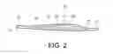 Fig. 03 - False lumen occluder