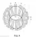 Fig. 05 - False lumen occluder