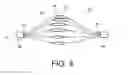 Fig. 06 - False lumen occluder